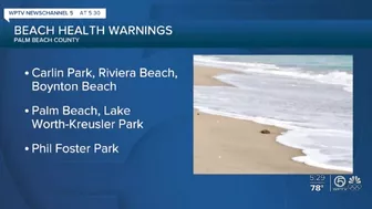 No swim advisories posted at 6 Palm Beach County beaches