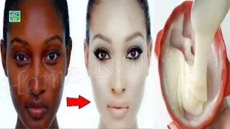 If You Need To Know The Celebrity Secret Of Skin Fairness, This Video Is For You