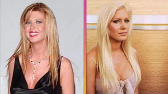 Celebrities Who REGRET Their Cosmetic Procedures