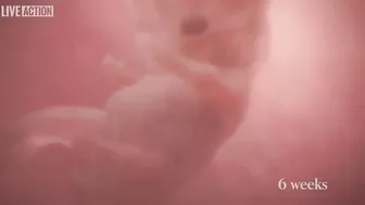 Meet Baby Olivia | A Never Before Seen Look At Human Life In The Womb