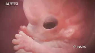 Meet Baby Olivia | A Never Before Seen Look At Human Life In The Womb