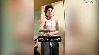 Watch People's Post Top Surgery Videos On TikTok