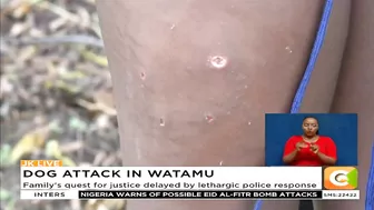 11yr old girl attacked by British national's dog at beach in Watamu