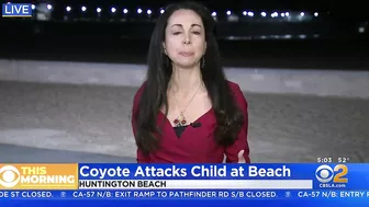 Girl attacked by coyote near Huntington Beach Pier