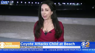 Girl attacked by coyote near Huntington Beach Pier