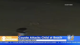 Girl attacked by coyote near Huntington Beach Pier