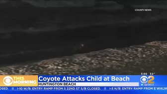 Girl attacked by coyote near Huntington Beach Pier