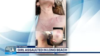 Girl assaulted in Long Beach