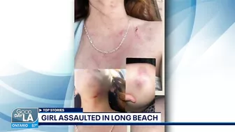 Girl assaulted in Long Beach