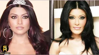 ಏನೋ ಮಾಡಲು ಹೋಗಿ! | Celebrity Cosmetic Plastic Surgery Gone Wrong | Chethana Raj