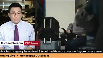 Canadian health officials issue travel notice over monkeypox