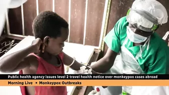 Canadian health officials issue travel notice over monkeypox