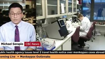 Canadian health officials issue travel notice over monkeypox