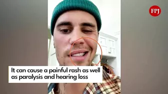 Justin Bieber reveals facial paralysis on Instagram Video