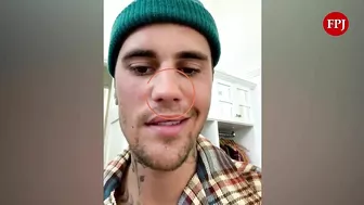 Justin Bieber reveals facial paralysis on Instagram Video