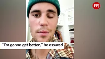 Justin Bieber reveals facial paralysis on Instagram Video