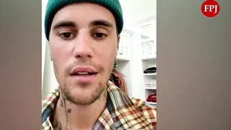 Justin Bieber reveals facial paralysis on Instagram Video