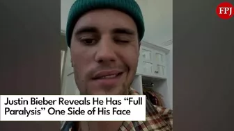 Justin Bieber reveals facial paralysis on Instagram Video