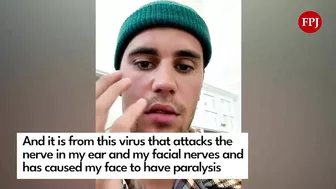 Justin Bieber reveals facial paralysis on Instagram Video