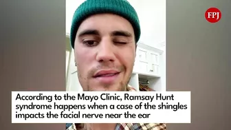 Justin Bieber reveals facial paralysis on Instagram Video