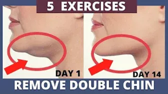 5 Exercises | How to Remove Double Chin ? Face Yoga and Double Chin