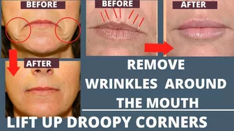 Remove Wrinkles and Droopy Corners of your Mouth | Face Yoga and Massage