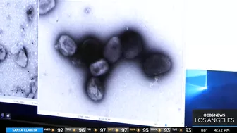 Health officials hold press conference in Long Beach to address rising Monkeypox cases