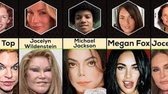 Comparison: Celebrity Plastic Surgery