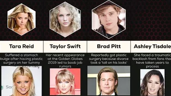 Comparison: Celebrity Plastic Surgery