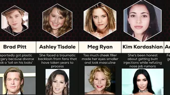 Comparison: Celebrity Plastic Surgery