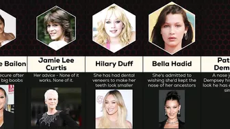 Comparison: Celebrity Plastic Surgery