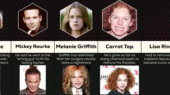 Comparison: Celebrity Plastic Surgery