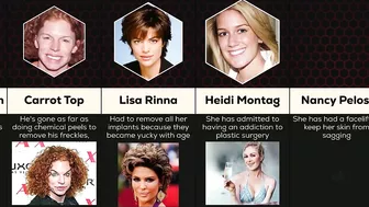 Comparison: Celebrity Plastic Surgery