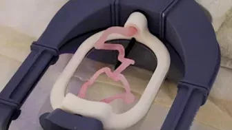 Mayo Clinic Minute - Using 3D printed and digital models for brain surgery