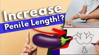 Does Penis Stretching Work? Stretching exercises | Urologist Explain ways to increase penile length