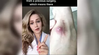 Doctor reacts to CRAZY medical TikToks | FootDocDana compilation