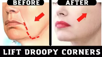 Lift up Droopy Corners. Face Yoga and Massage