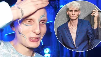 Łukasz po "Top Model" miał ogromne problemy! Co dalej z jego karierą modela?