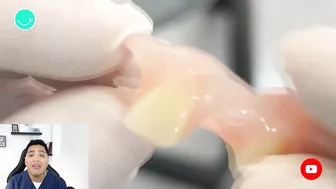 Como RECUPERAR DIENTES con una protesis invisible #viral #shorts #short #protesisdental