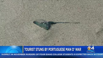 South Beach Tourist Stung By Portuguese Man O' War