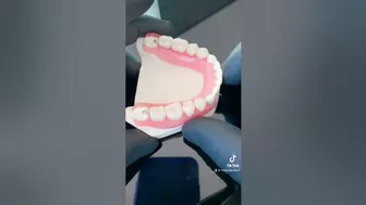 CUÁNTO CUESTA UNA DENTADURA Flexible ?? ???? #viral