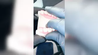 CUÁNTO CUESTA UNA DENTADURA Flexible ?? ???? #viral