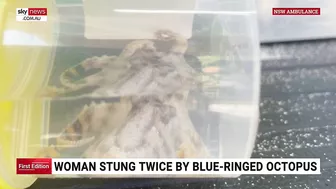 Woman bitten by blue-ringed octopus at Sydney beach