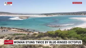 Woman bitten by blue-ringed octopus at Sydney beach