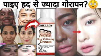 पाइए हद से ज्यादा गोरापन?| OMY LADY Skin Whitenig Cream | Reduce Skin Darkness, Dark Sports & Marks?