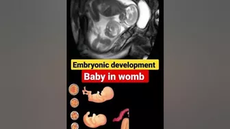 Embryonic development #ytshorts #foryou #share #viral #trending #shorts #short #motivation