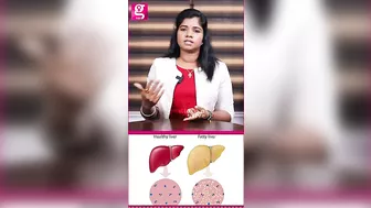 Fatty Liver-அ எப்படி Cure பண்றது? - Siddha Dr. B Yoga Vidya | PCOD #healthcaretips #galattapink