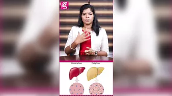 Fatty Liver-அ எப்படி Cure பண்றது? - Siddha Dr. B Yoga Vidya | PCOD #healthcaretips #galattapink