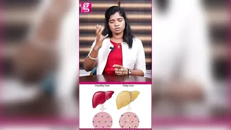 Fatty Liver-அ எப்படி Cure பண்றது? - Siddha Dr. B Yoga Vidya | PCOD #healthcaretips #galattapink