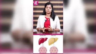 Fatty Liver-அ எப்படி Cure பண்றது? - Siddha Dr. B Yoga Vidya | PCOD #healthcaretips #galattapink